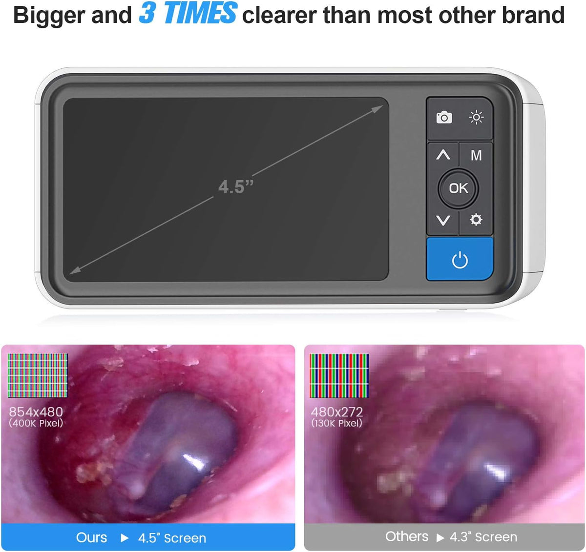 Digital Otoscope with 4.5 Inches Screen, 3.9mm Ear Camera, 6 LED Lights, 32GB Card, Ear Wax Removal Tool, 2500 mAh Rechargeable Battery, Pack of 2 A8547