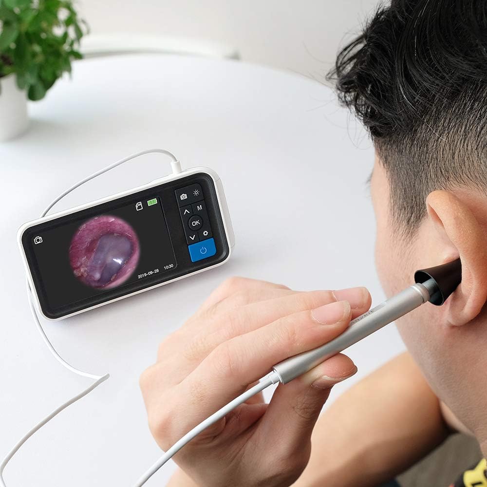 Digital Otoscope with 4.5 Inches Screen, 3.9mm Ear Camera, 6 LED Lights, 32GB Card, Ear Wax Removal Tool, 2500 mAh Rechargeable Battery, Pack of 2 A8547